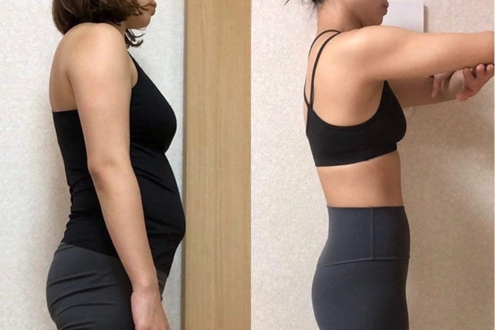 ダイエット整体の施術前後（Before/After）の体型比較写真（女性・横向き）